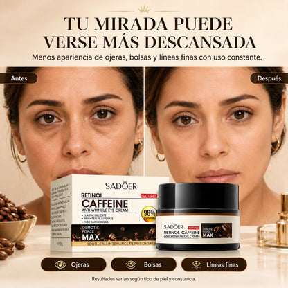 Crema Contorno de Ojos con Retinol y Cafeína | Reduce Ojeras y Arrugas