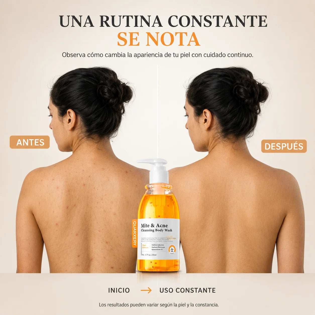 Gel Corporal para Piel con Acné Quarxery | Limpieza Profunda 250 ml