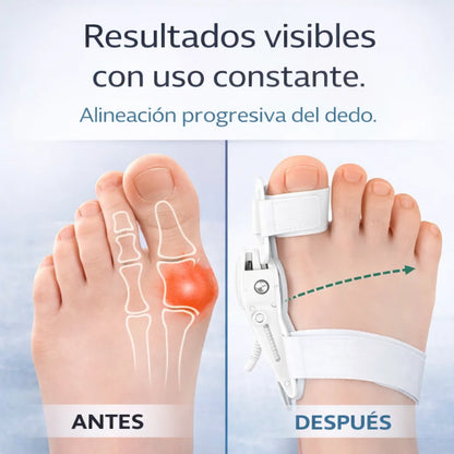 PasoFirme™ | Soporte Diario para Reducir la Molestia del Juanete