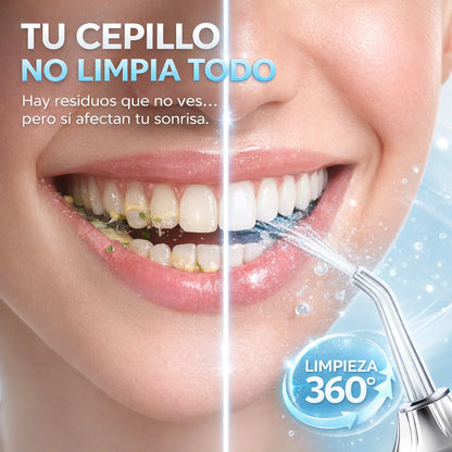 Irrigador Electrico Dental de Alta Presión