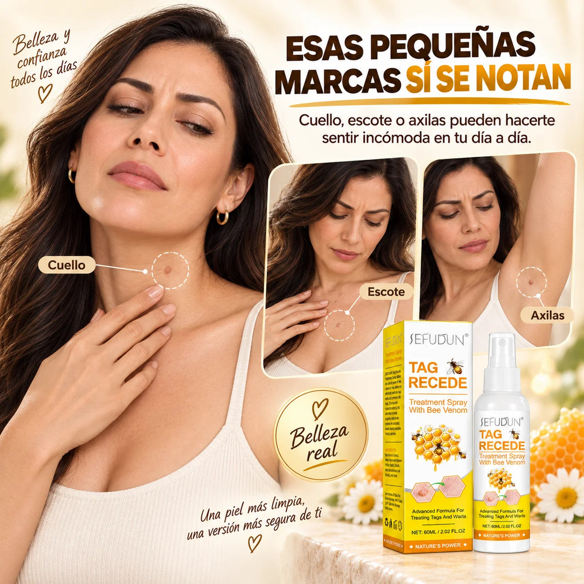 Spray con Veneno de Abeja | Para Verrugas y Marcas Cutáneas