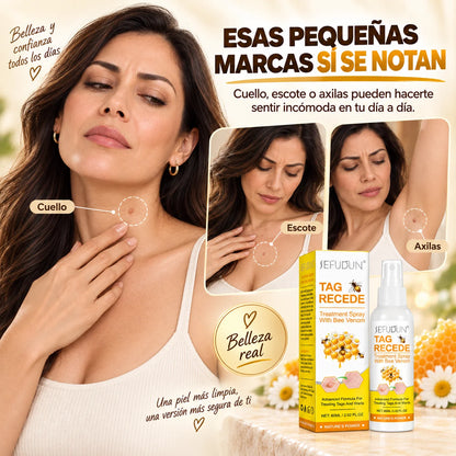 Spray con Veneno de Abeja | Para Verrugas y Marcas Cutáneas